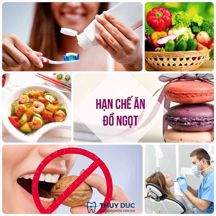 Hướng dẫn cách phòng tránh bị sâu răng số 7 1 Hướng dẫn cách phòng tránh bị sâu răng số 7 1