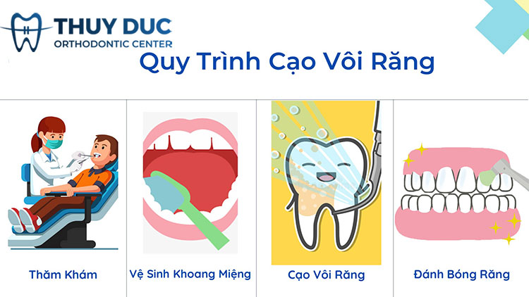 Quy trình lấy cao răng chuẩn y khoa 1