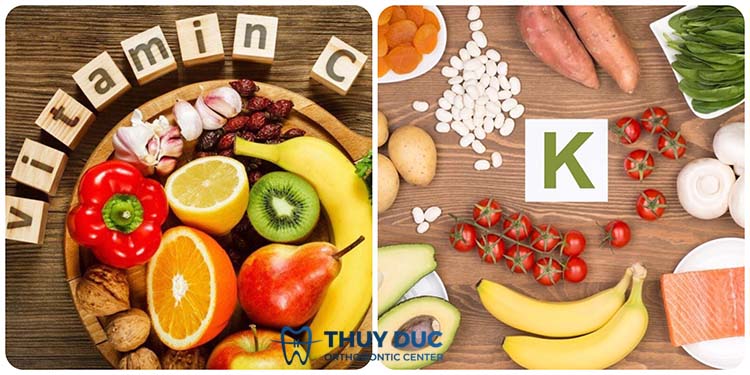 Tìm hiểu nguyên nhân gây chảy máu chân răng thường xuyên 2 Tìm hiểu nguyên nhân gây chảy máu chân răng thường xuyên 2