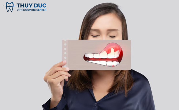 Thường xuyên chảy máu chân răng có nguy hiểm không? 1 Thường xuyên chảy máu chân răng có nguy hiểm không? 1