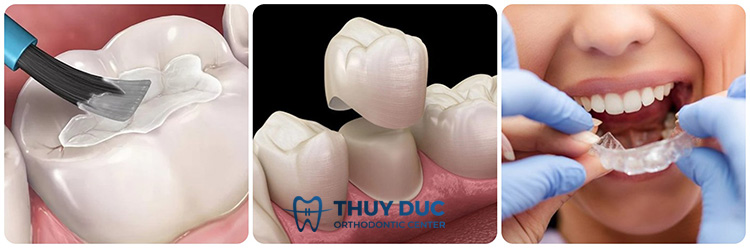 Điều trị tại nha khoa 1