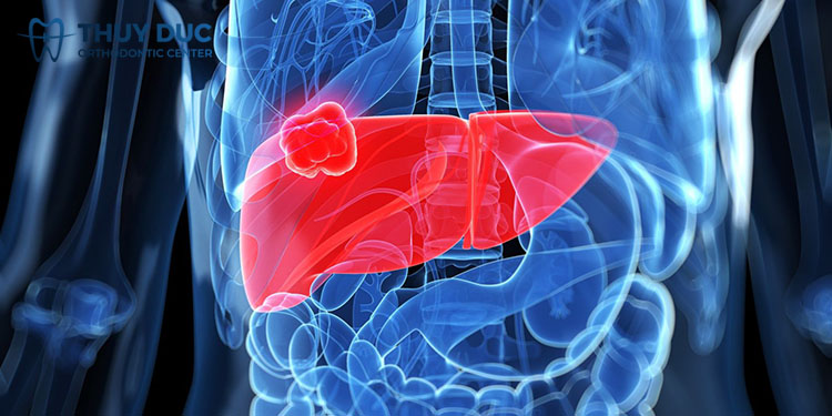 Tìm hiểu nguyên nhân gây chảy máu chân răng 3