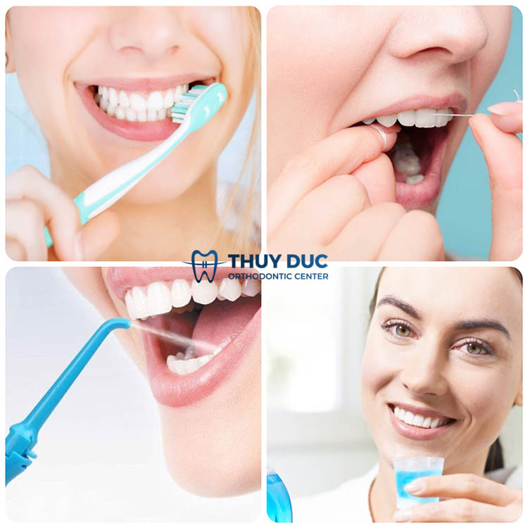 Vệ sinh răng miệng đúng cách 1