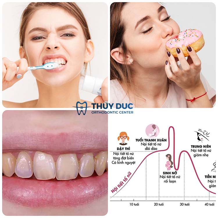 Tìm hiểu những nguyên nhân làm cho răng vĩnh viễn bị sâu 1 Tìm hiểu những nguyên nhân làm cho răng vĩnh viễn bị sâu 1