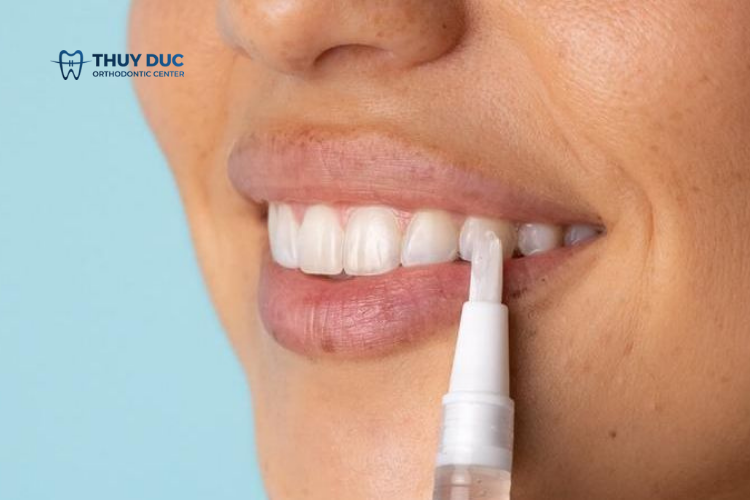 Cách sử dụng bút tẩy trắng răng 1 Cách sử dụng bút tẩy trắng răng 1