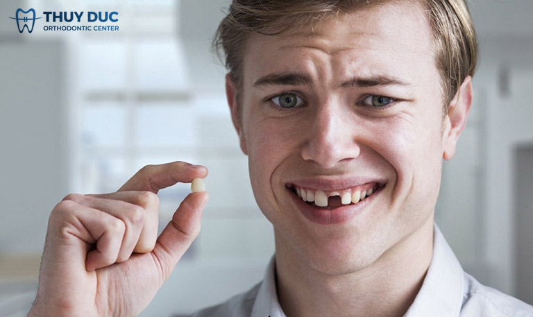 Mơ gãy răng dưới góc độ khoa học 1 Mơ gãy răng dưới góc độ khoa học 1