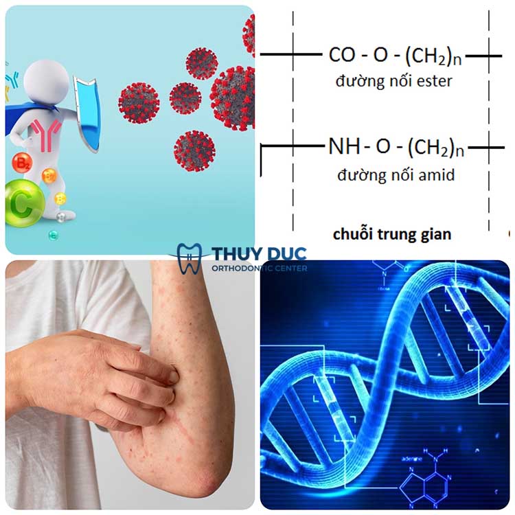 Các nguyên nhân dẫn đến dị ứng thuốc tê khi nhổ răng khôn 1 Các nguyên nhân dẫn đến dị ứng thuốc tê khi nhổ răng khôn 1