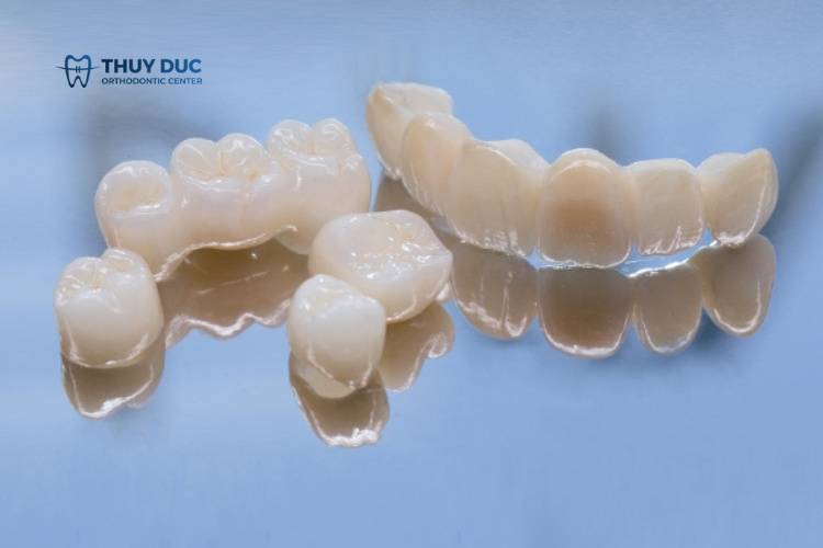 Bọc răng sứ Implant răng toàn sứ 1 Bọc răng sứ Implant răng toàn sứ 1