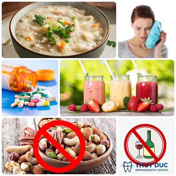 4. Những lưu ý sau khi nhổ răng 1