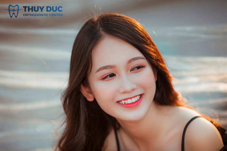 1. Răng khểnh là gì? Cần niềng răng trong trường hợp nào? 1